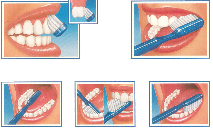 Como lavarse bien los dientes